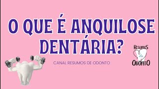 O que é anquilose dentária [upl. by Chiou]