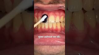 Instant White Teeth Formula  How to Get White Teeth At Home  Yellow Teeth Whitening In 48 Hours [upl. by Any436]