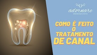 Como é Feito o Tratamento de Canal  Dicas de Saúde Bucal [upl. by Kemppe82]