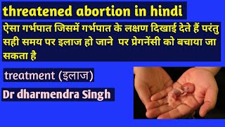 threatened abortion in hindi  threatened abortion treatment  abortion miscarriages [upl. by Asilet]