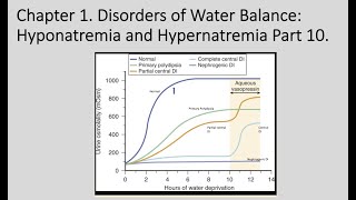 Hypernatremia Part 2 Water Deprivation Test and Management [upl. by Notseh]