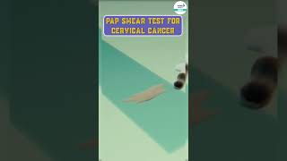 Pap Smear Test For Cervical Cancer  shorts biology neetpreparation  InfinityLearnNEET [upl. by Alliber]