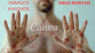 10 VIRUS MAIS DEVASTADORES DO MUNDO [upl. by Navap]