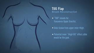 TUG Flap Breast Reconstruction Animation [upl. by Cornew583]