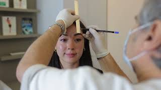 Dr Jules Nabet  Upper Face Botox Antiwrinkle injections Forehead Lines Chin Botox Crows Feet [upl. by Retsae]