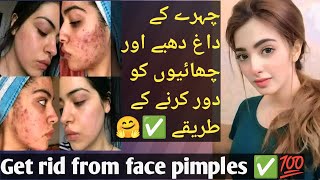 How to Get rid from face pimples and Acne by Health amp Beauty [upl. by Nellaf]