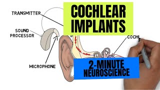 2Minute Neuroscience Cochlear Implants [upl. by Asilanna]