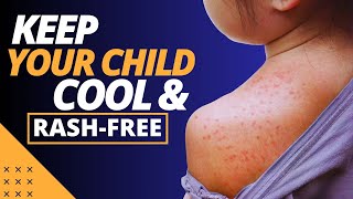 What Is the Best Way to Prevent Heat Rash in Children [upl. by Mobley]