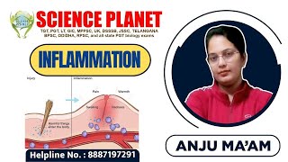 INFLAMATION II BY ANJU MAM II SCIENCE PLANET II [upl. by Sukramed]