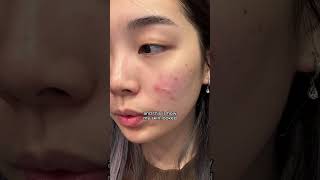 best korean skincare products to restore damaged skin barrier I MANYO BIFIDA TONER amp AMPOULE shorts [upl. by Izogn919]