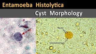 Entamoeba Histolytica Cyst Morphology [upl. by Ennaeirrac]