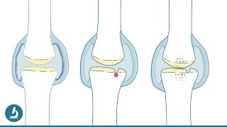 Starke Gelenke 💪 Was macht das Knie gesund und glücklich [upl. by Laurence]