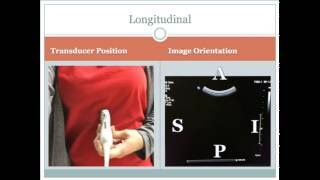 Image Orientation and Transducer Position [upl. by Eidnar]