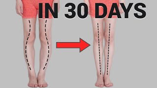 Get Straight Legs in 30 Days Fix O or XShaped Legs Knee Internal Rotation [upl. by Conner561]