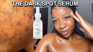 HOW TO GET RID OF DARK SPOTS WITH ONE PRODUCT  The ordinary [upl. by Yeblehs]