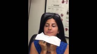 Nasal Splint removal  Post Surgery Septoplasty Rhinoplasty Full Video [upl. by Kristianson]