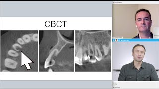 Case Report Cervical Root Resorption with Dr Adrian Lozano [upl. by Erlandson771]