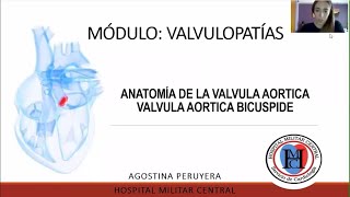 Anatomía valvula aortica valvula aortica bicuspide  Módulo Valvulopatías [upl. by Polak]