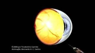 ANIMAÃ‡ÃƒO DE OLHO HUMANO TRATAMENTO PARA UM TIPO DE DESLOCAMENTO DE RETINA [upl. by Atinnor]