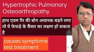 Hypertrophic pulmonary osteoarthropathy causes symptoms diagnosis Treatment pathology [upl. by Nwahsed]