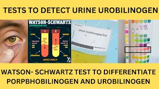 TESTS TO DETECT UROBILINOGEN IN THE URINE EhrlichsTEST PORPHOBILINOGEN TESTWatsonSchwartz Test [upl. by Radmilla]