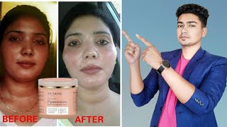 Nuskhe pigmentation cream by paras tomar  Review  Benefits and side effects [upl. by Bloch]