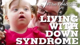 Down Syndrome Life [upl. by Nessnaj781]