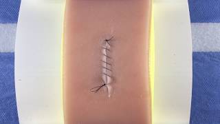 Simple Continuous Running Baseball Suture [upl. by Eidnarb]