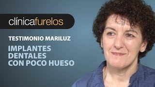 Mari Luz Implantes dentales con poco hueso [upl. by Ihsorih869]