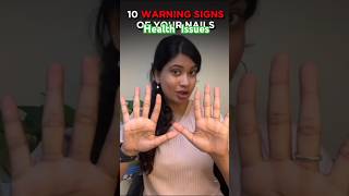 HEALTH ISSUES YOU SHOULD KNOW Bankfirstaidtvhealth healthy healthtips healthylifestyle [upl. by Atem]