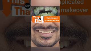 Complicated Smile Makeover Dr Srishti Bhatia smile smilemakeover [upl. by Pearlman658]