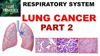 LUNG CANCER  Part 2 Morphology Clinical features [upl. by Enyamrahs]