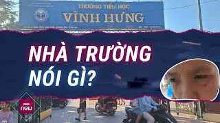 Nhà trường nói gì về việc 3 giáo viên đứng nhìn nữ sinh lớp 5 bị bạn đánh rách mặt  VTC Now [upl. by Maje]