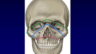 Facial Fractures 1 [upl. by Hardie197]