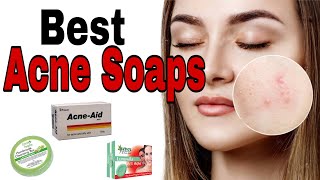 Top 13 Soaps for Acne 2020 Best Soap Bars for Oily Acne prone skin amp Blackheads Sri Lanka [upl. by Aldarcie]