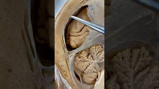 Incredible Tissue Surrounding Your Brain  Institute of Human Anatomy [upl. by Egedan412]