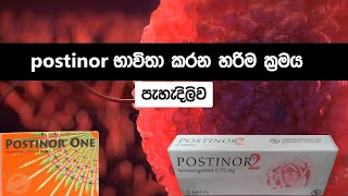 උපත් පාලනයට postinor භාවිතා කරන නිවැරදි ආකාරය 😨 How to use postinor 1 and 2 tablets sinhala [upl. by Selwyn]