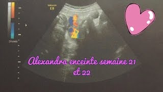 Alexandra enceinte  semaines 21 et 22 [upl. by Hagan]