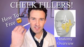 Cheek Fillers Feminine face My technique [upl. by Molahs]