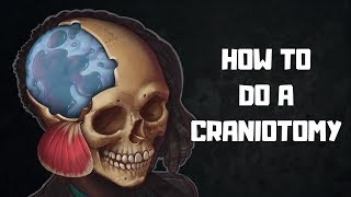 How to do a craniotomy [upl. by Naro]