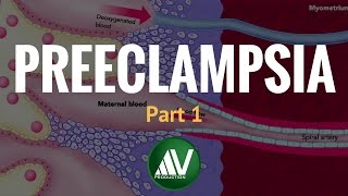 Preeclampsia Part 1 [upl. by Eednarb]