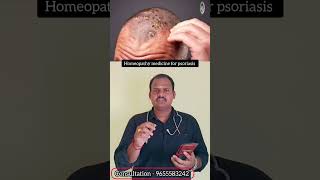 Psoriasis treatment in tamil Dr Balajimuthu [upl. by Inalaehon]