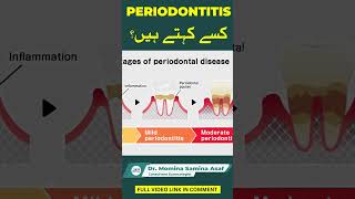 Periodontitis 🦷  Dr Muhammad Ahad Shabbir [upl. by Arriaet]