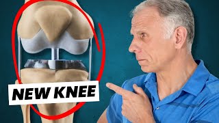 7 Ways to Decrease Pain in A Knee Replacement [upl. by Tompkins]