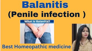 Balanitis  Penis infection treatment  Balanitis symptoms causes amp Homeopathic medicine hindi [upl. by Eciened]