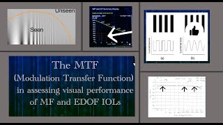 The MTFModulation Transfer Function and its role in assessing visual performance of premium IOLS [upl. by Rakia]