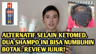 ALTERNATIF SHAMPO SELAIN KETOMED UNTUK MENUMBUHKAN RAMBUT BOTAK TENGAH REVIEW REVITA DAN ALPECIN [upl. by Nichani]