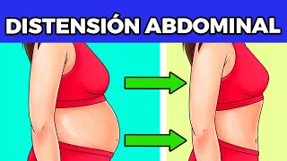 Como reducir la distension abdominal rapidamente [upl. by Jerusalem]