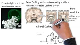 Cushings syndrome vs Cushings disease Symptoms Treatment Prognosis [upl. by Aneehsit986]