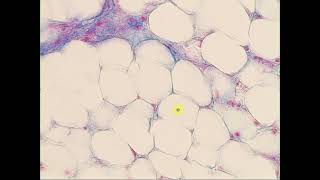 Loose c t  Adipose tisse Massons Trichrome Adipose tissue [upl. by Lindholm]